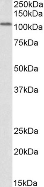 LSD1 Polyclonal Antibody