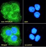 MYPT1 Antibody in Immunocytochemistry (ICC/IF)