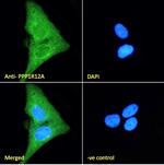 MYPT1 Polyclonal Antibody