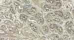 MYPT1 Antibody in Immunohistochemistry (Paraffin) (IHC (P))