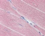 MYPT1 Antibody in Immunohistochemistry (Paraffin) (IHC (P))