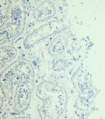 MYPT1 Antibody in Immunohistochemistry (Paraffin) (IHC (P))
