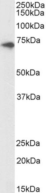 PMP70 Polyclonal Antibody, Biotin