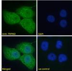 TRPM2 Polyclonal Antibody
