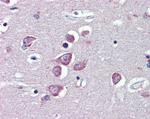 TRPM2 Antibody in Immunohistochemistry (Paraffin) (IHC (P))