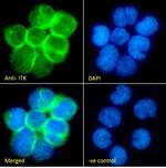 ITK Polyclonal Antibody