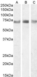ITK Antibody in Western Blot (WB)