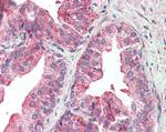 KIF6 Antibody in Immunohistochemistry (Paraffin) (IHC (P))