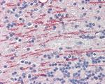 CYP26A1 Antibody in Immunohistochemistry (Paraffin) (IHC (P))