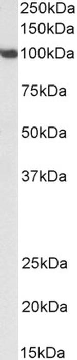 SP1 Polyclonal Antibody