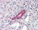 ROR1 Antibody in Immunohistochemistry (Paraffin) (IHC (P))