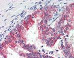 ROR1 Antibody in Immunohistochemistry (Paraffin) (IHC (P))
