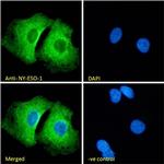 CTAG1B Polyclonal Antibody