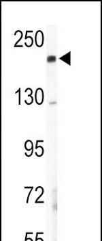 COL5A2 Polyclonal Antibody