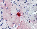 MCPT4 Antibody in Immunohistochemistry (Paraffin) (IHC (P))