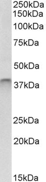 SPO11 Polyclonal Antibody