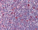 TYROBP Antibody in Immunohistochemistry (Paraffin) (IHC (P))