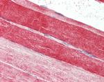 FABP7 Antibody in Immunohistochemistry (Paraffin) (IHC (P))