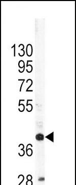 Apolipoprotein L1 Antibody in Western Blot (WB)
