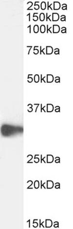 CLEC2D Antibody in Western Blot (WB)
