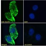 GLUT2 Antibody in Immunocytochemistry (ICC/IF)