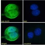 GLUT2 Polyclonal Antibody
