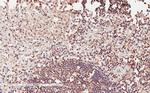 ICOS (CD278) Antibody in Immunohistochemistry (Paraffin) (IHC (P))