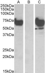 EPM2AIP1 Antibody in Western Blot (WB)