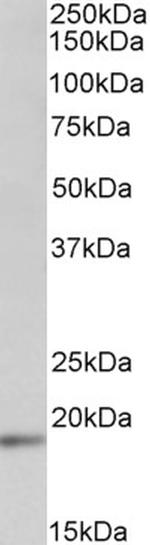 UBE2C Antibody in Western Blot (WB)