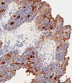 CEACAM1 Polyclonal Antibody