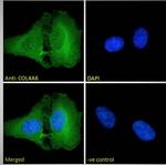 COL4A6 Polyclonal Antibody