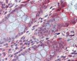 TPCN2 Antibody in Immunohistochemistry (Paraffin) (IHC (P))