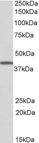 TRIB1 Polyclonal Antibody