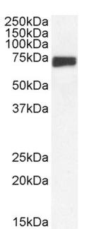 MNT Polyclonal Antibody