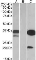 DAPP1 Polyclonal Antibody