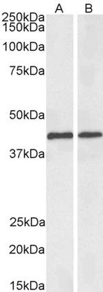ACAT1 Polyclonal Antibody, Biotin