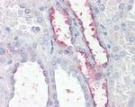 KCNE3 Polyclonal Antibody