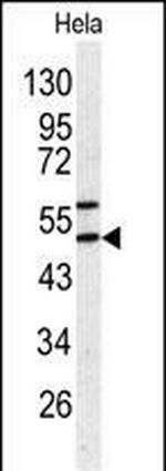 SERPINH1 Antibody in Western Blot (WB)