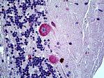 Ephrin A5 Antibody in Immunohistochemistry (Paraffin) (IHC (P))