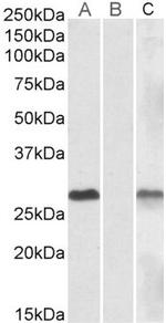 DYDC1 Polyclonal Antibody