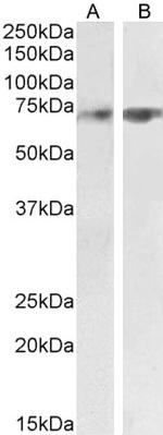 HRD1 Antibody in Western Blot (WB)