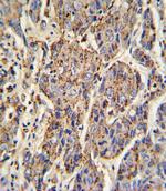 Cathepsin B Polyclonal Antibody