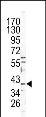 Cathepsin B Antibody in Western Blot (WB)