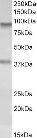 AOC3 Polyclonal Antibody