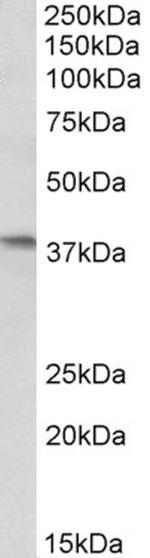 AIM2 Polyclonal Antibody