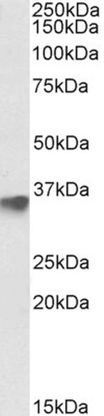 FBXO4 Polyclonal Antibody
