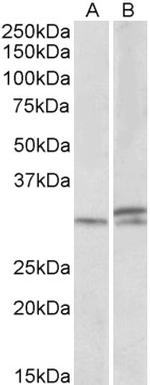 HOXA9 Polyclonal Antibody