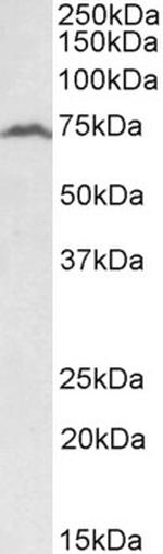 RFX5 Antibody in Western Blot (WB)
