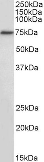 RFX5 Antibody in Western Blot (WB)