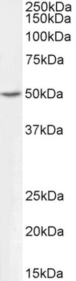 ALDH9A1 Polyclonal Antibody, Biotin